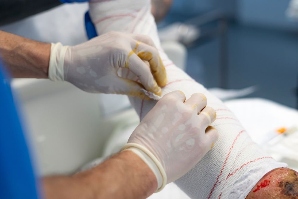 Severe Burn Injury Lawyer – New Jersey | Lackey & Miller